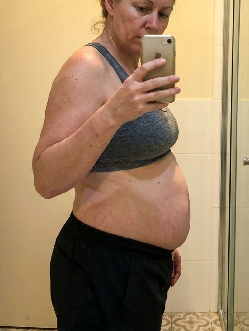 Before — bloated stomach