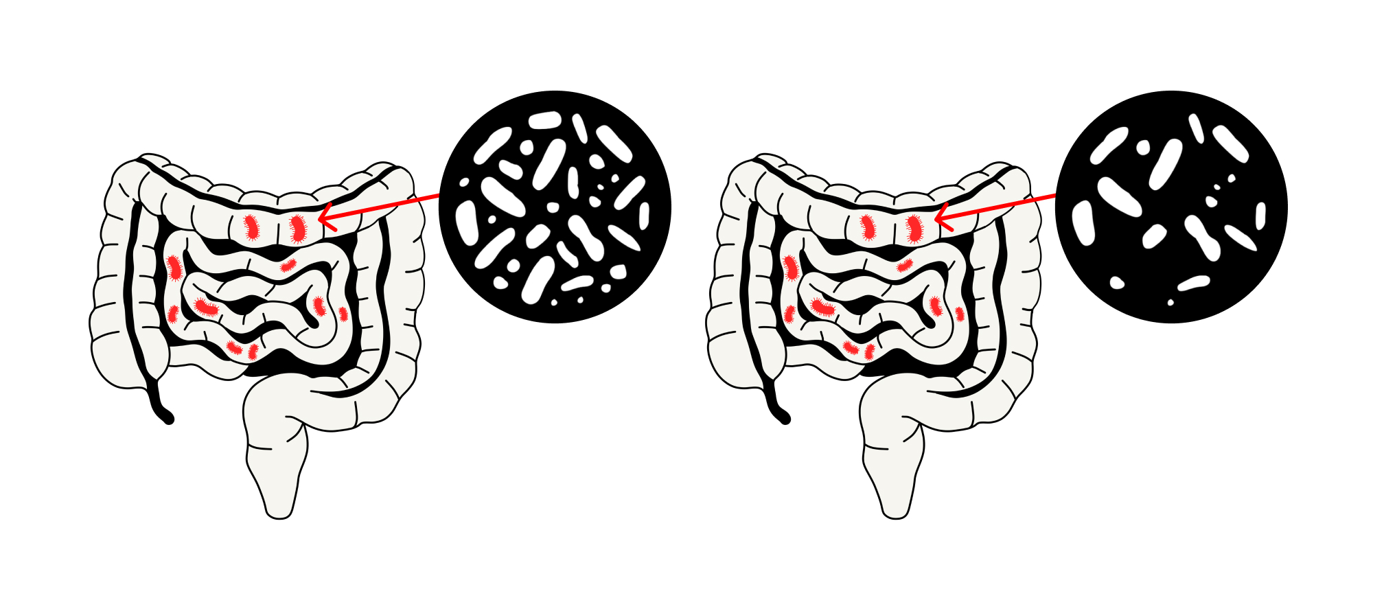 Gut bacteria shift with age